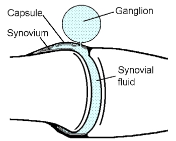Ganglion